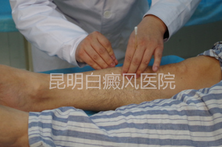 治疗白癜风的中医医生